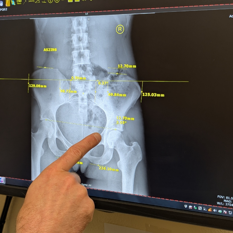 second chiropractic visit